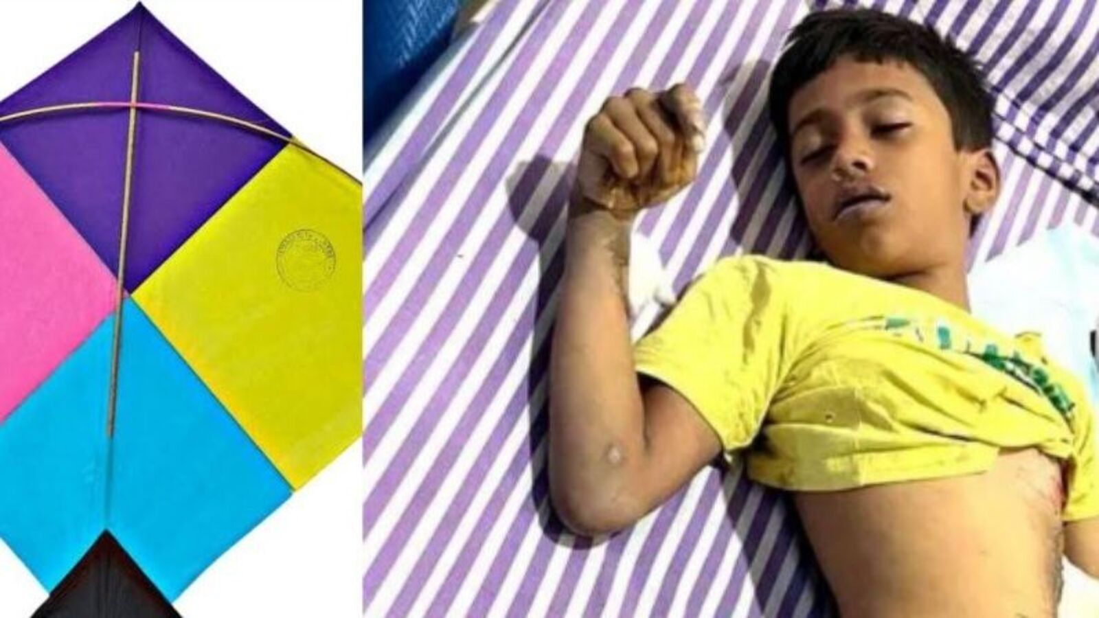 Hyderabad Kite Accidents: ప్రాణం తీసిన పతంగులు.. హైదరాబాద్‌లో బాలుడు మృతి