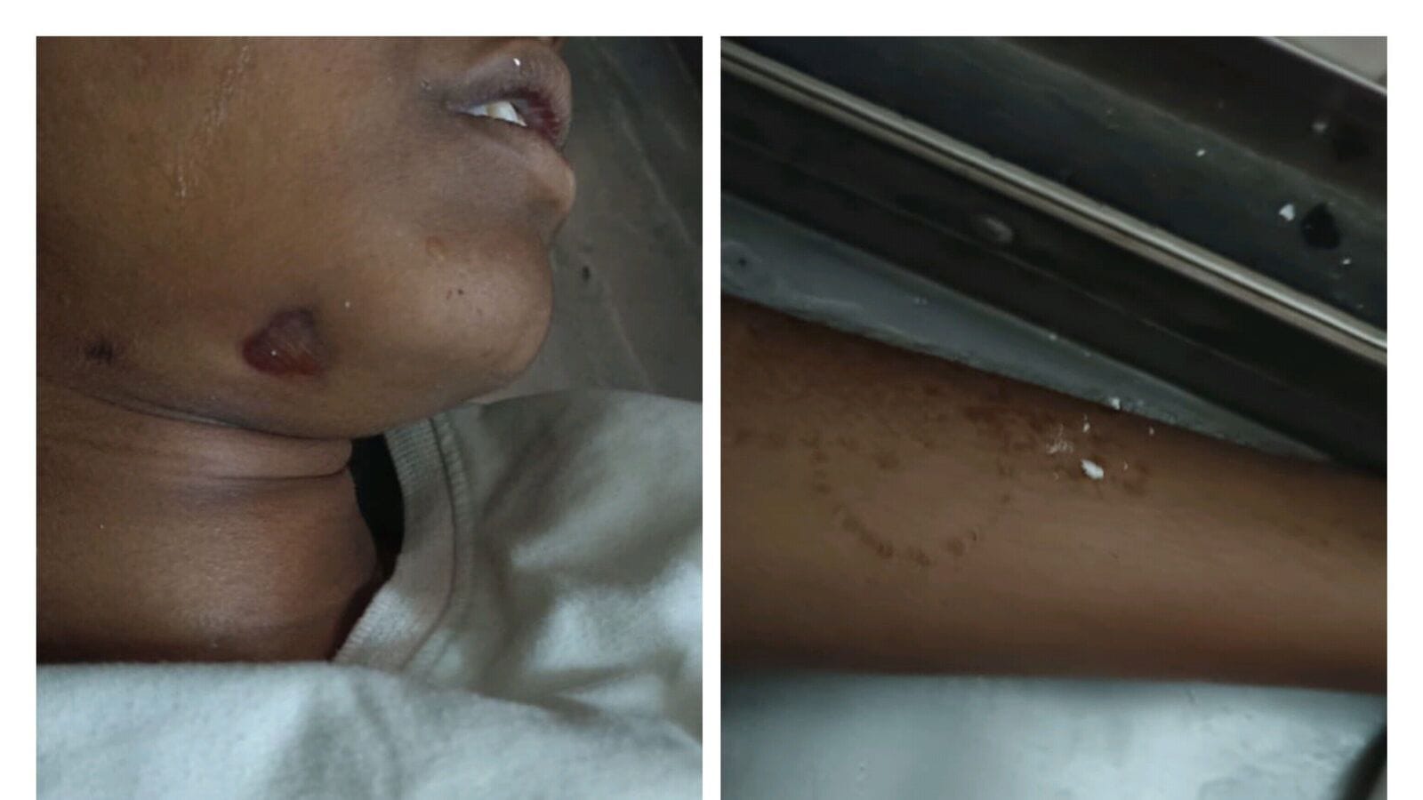 Bhuvanagiri Suicides: ఎస్సీ హాస్టల్లో ఇద్దరు విద్యార్ధినుల ఆత్మహత్య.. భువనగిరిలో తీవ్ర ఉద్రిక్తత