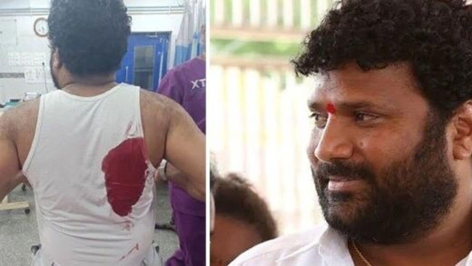 Self Attack For Security: గన్‌మెన్‌ కోసం హత్యాయత్నం డ్రామా..బీజేపీ నాయకుడిపై కేసు నమోదు చేసిన పోలీసులు