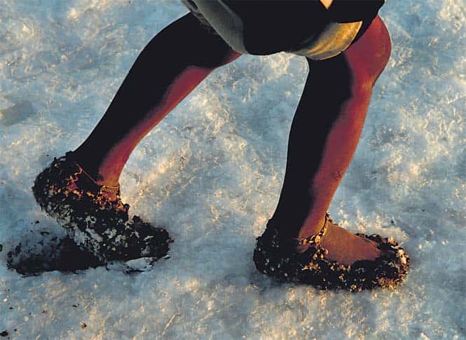 Working barefoot, with their skin overexposed to saline chemicals and harsh sunlight, skin diseases are rife among the workers here. (HT photo) 
</div)
