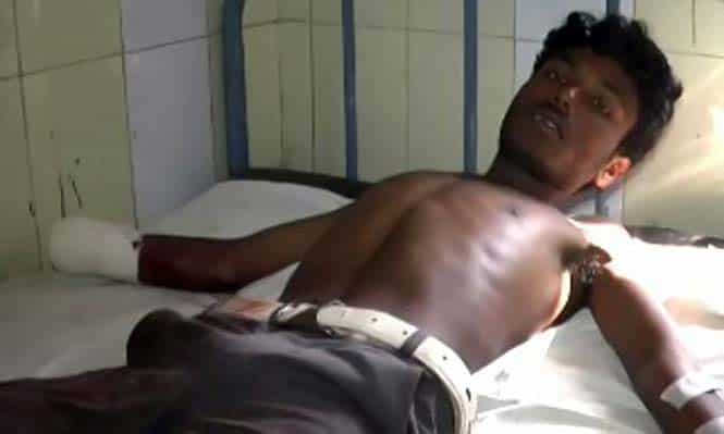 Jialu Nial, the migrant labourer - whose hands were chopped by a labour contractor - lying on his bed in Bhawanipatna district headquarters hospital. (HT Photo) Jialu Nial, the migrant labourer - whose hands were chopped by a labour contractor - lying on his bed in Bhawanipatna district headquarters hospital. (HT Photo)