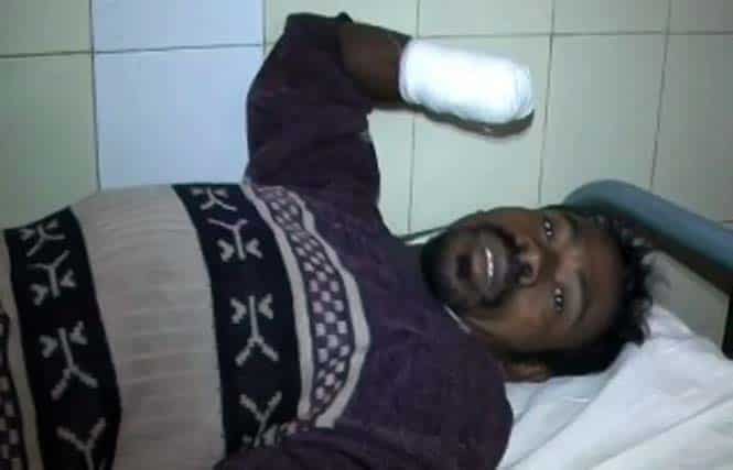 Nilambar Dhangdamajhi, the migrant labourer - whose hands were chopped by a labour contractor - lying on his bed in Bhawanipatna district headquarters hospital. (HT Photo) Nilambar Dhangdamajhi, the migrant labourer - whose hands were chopped by a labour contractor - lying on his bed in Bhawanipatna district headquarters hospital. (HT Photo)