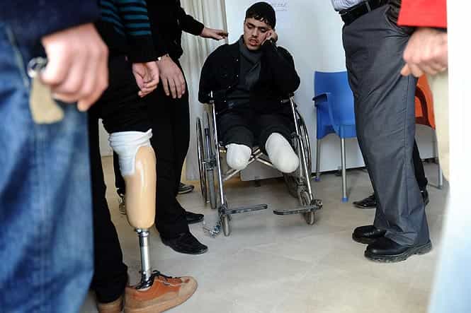 An injured Syrian man waits for his new prosthetic limbs in Ryhanli, a border town near Hatay, southern Turkey. (AFP Photo)
</div) An injured Syrian man waits for his new prosthetic limbs in Ryhanli, a border town near Hatay, southern Turkey. (AFP Photo)
</div)