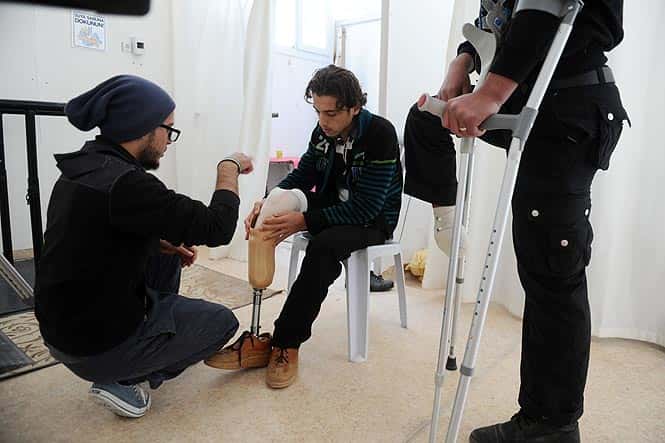 An injured Syrian man puts on his new prosthetic limb in Ryhanli, a border town near Hatay, southern Turkey. (AFP Photo)
</div) An injured Syrian man puts on his new prosthetic limb in Ryhanli, a border town near Hatay, southern Turkey. (AFP Photo)
</div)