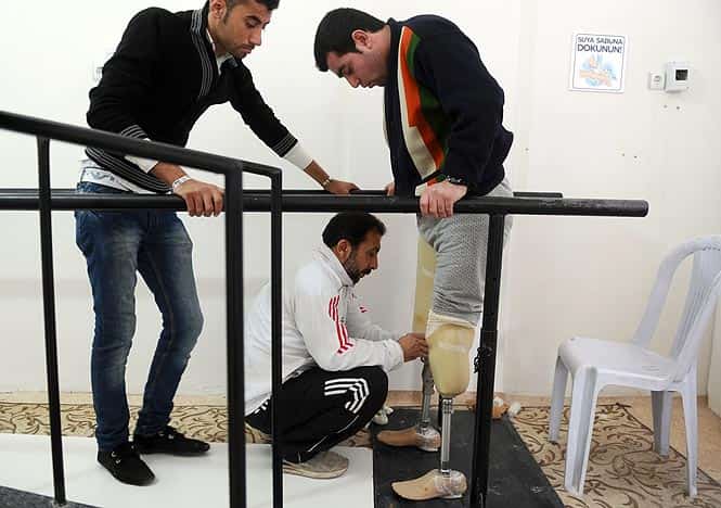 An injured Syrian man prepares to exercise with his new prosthetic limbs in Ryhanli, a border town near Hatay, southern Turkey. (AFP Photo)
</div) An injured Syrian man prepares to exercise with his new prosthetic limbs in Ryhanli, a border town near Hatay, southern Turkey. (AFP Photo)
</div)