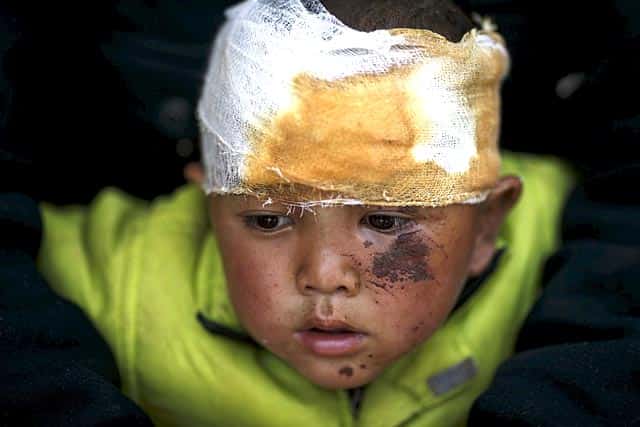 Abhishek Tamang, 4, looks on after receiving medical treatment, following the earthquake, at Dhading hospital, in Dhading Besi, Nepal on April 27, 2015. Reuters Photo/Athit Perawongmetha Abhishek Tamang, 4, looks on after receiving medical treatment, following the earthquake, at Dhading hospital, in Dhading Besi, Nepal on April 27, 2015. Reuters Photo/Athit Perawongmetha