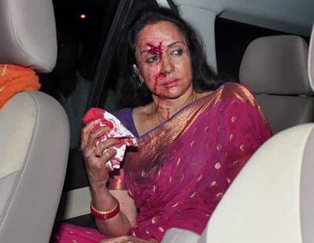 In pics: Hema Malini injured, child killed in road accident | Latest News  India - Hindustan Times