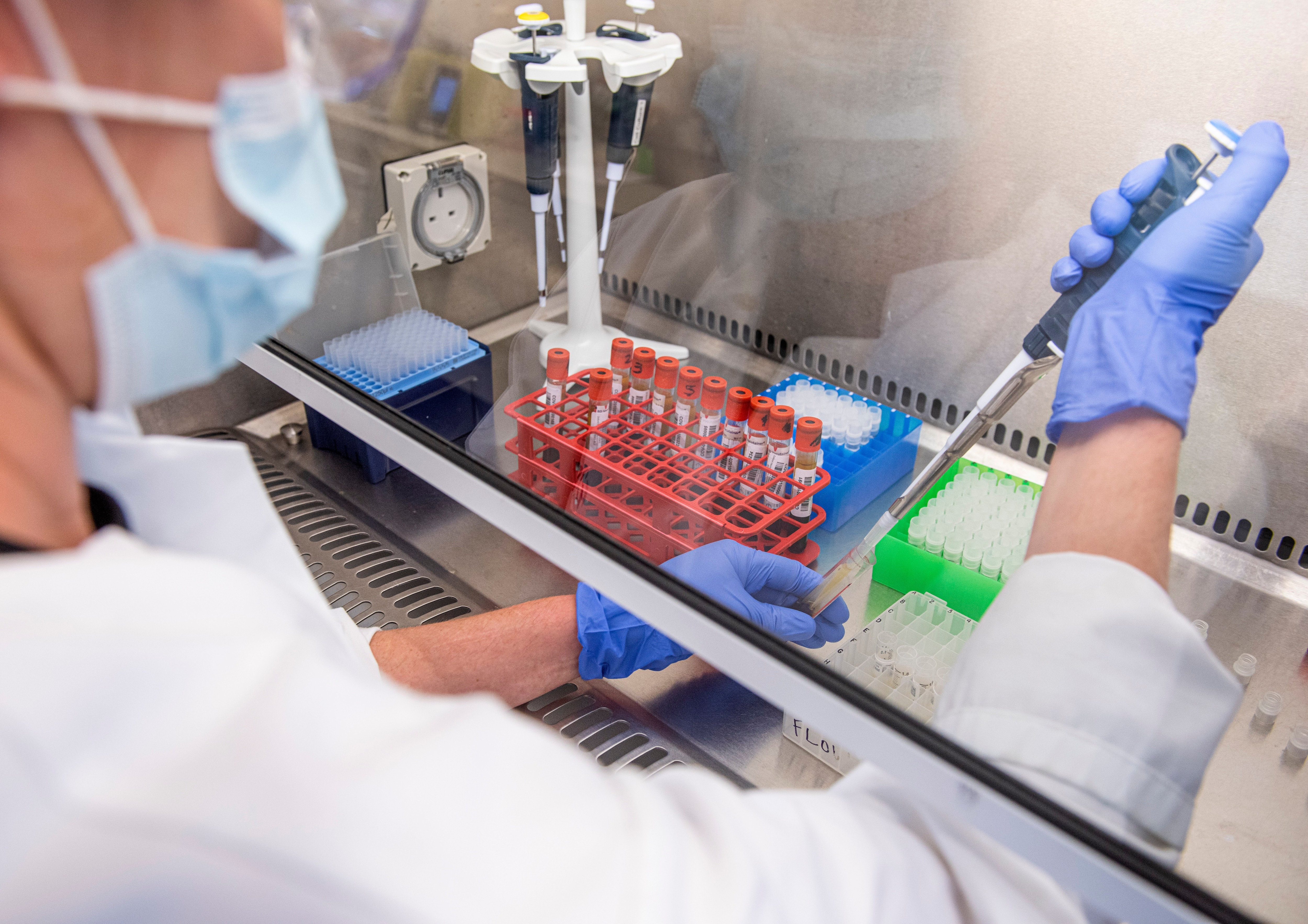 生物学的E：会社が開発しようとしている解毒剤は前臨床段階にあります。 （画像記号、礼儀AP）