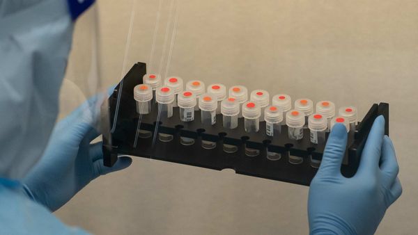 RT-PCR পরীক্ষা (Bloomberg)