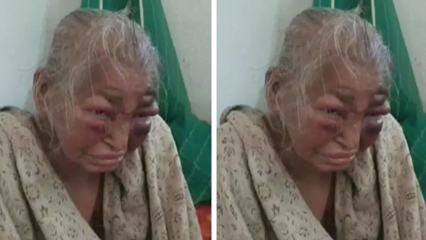 'আক্রান্ত' বৃদ্ধা। (ফাইল ছবি সৌজন্য এএনআই)। 'আক্রান্ত' বৃদ্ধা। (ফাইল ছবি সৌজন্য এএনআই)।