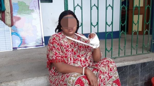 স্ত্রীর হাতে ধারালো অস্ত্র দিয়ে কোপ দেওয়ার অভিযোগ স্বামীর বিরুদ্ধে উঠেছে (নিজস্ব চিত্র ) স্ত্রীর হাতে ধারালো অস্ত্র দিয়ে কোপ দেওয়ার অভিযোগ স্বামীর বিরুদ্ধে উঠেছে (নিজস্ব চিত্র )