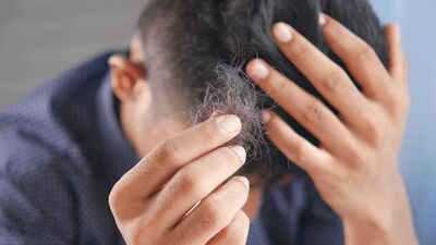 सध्या अनेक लोकांना केसांमध्ये कोंडा होणं किंवा केसगळतीची समस्यांचा सामना करावा लागत आहे. या समस्येवर मात करण्यासाठी अनेकजण महागडे औषधं वापरतात, परंतु त्यांना या समस्येपासून मुक्तता मिळत नाही.
