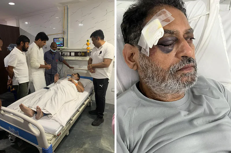 Nitin Raut in Bharat Jodo Yatra : कॉंग्रेसच्या भारत जोडो यात्रेत सहभागी होण्यासाठी गेलेले माजी ऊर्जामंत्री नितीन राऊत यांना तेलंगणात पोलिसांनी धक्काबुक्की केल्याची घटना समोर आली आहे. त्यात त्यांच्या डोळ्याला गंभीर मार लागला आहे. 