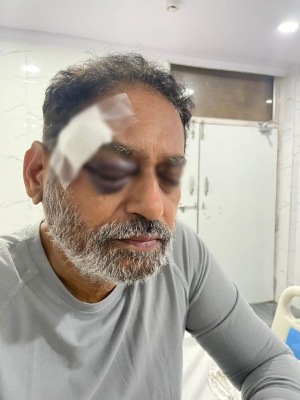 त्यानंतर कॉंग्रेस कार्यकर्त्यांनी राऊतांना उपचारासाठी तातडीनं हैदराबादेतील एका रुग्णालयात दाखल केलं आहे.