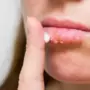<p>ঠোঁট ফাটার সমস্যা থেকে মুক্তির উপায়</p>