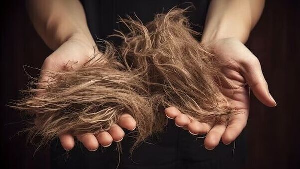 Hair Fall: গোছা গোছা চুল ঝরছে? এই খাবারেই মুশকিল আসান – Hair Fall: these foods can easily reduce your hair fall.