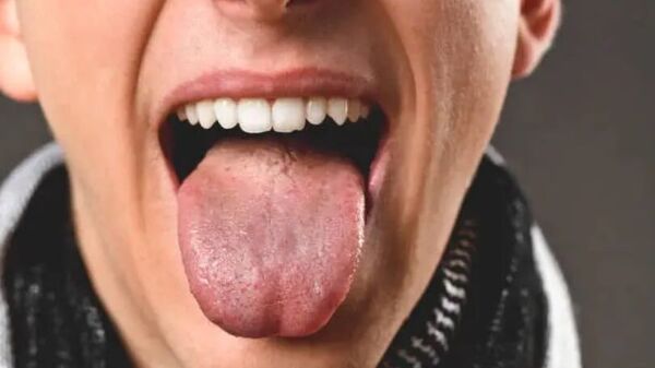 AI model to analyse tongue: জিহ্বা বিশ্লেষণ করবেন? নির্ভুলতার সঙ্গে পরিস্থিতি সনাক্ত করতে আসছে এআই মডেল