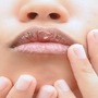 বার বার লিপবাম লাগিয়েও ঠোঁট ফাটা কমছে না? এই ঘরোয়া উপায়েই ঠোঁট হবে তুলতুলে নরম (প্রতীকী ছবি)