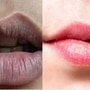 শীতে ঠোঁট খসখসে, কালো হয়ে যাচ্ছে? রান্নাঘরের এই মশলাতেই ঠোঁট হবে গোলাপের মতো নরম