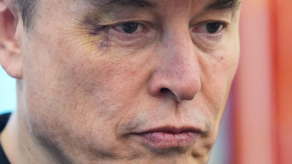 এদিকে সেই সংবাদ সম্মেলনের একটি ক্লিপ দ্রুত সোশ্যাল মিডিয়ায় ভাইরাল হয়ে যায়। তাতে মাস্কের মাদক সেবনের বিষয়ে আরও জল্পনা বেড়েছে। সেখানে দেখা যায়, ইলন মাস্কের চোখের তলায় কালশিটে। এদিকে অস্বাভাবিক ভাবে মাথা ঘোরাচ্ছেন মাস্ক। মাঝে মাঝে এবর চোখের মণিও ঘোরাচ্ছেন। কখনও আবার চোখের পাতা বন্ধ করছেন। সেই ভিডিয়ো ক্লিপে মাস্কের মাদক সেবনের সম্ভাবনা নিয়ে জল্পনা বেড়েছে। (AP)