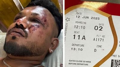 একেবারে অলৌকিক ঘটনা ঘটল! অভিশপ্ত এয়ার ইন্ডিয়ার ড্রিমলাইনার বিমানে থাকা কমপক্ষে এক যাত্রীর প্রাণরক্ষা পেল। বিশ্বাসকুমার রমেশ নামে ৪০ বছরের ওই ব্যক্তি এয়ার ইন্ডিয়ার ৭৮৭-৮ ড্রিমলাইনার বিমানের ১১এ আসনে বসেছিলেন। বরাতজোরে প্রাণে বেঁচে গিয়েছেন। আপাতত আমদাবাদের সিভিল হাসপাতালের তাঁর চিকিৎসা চলছে। জেনারেল বেডেই রাখা হয়েছে তাঁকে। (ছবি সৌজন্যে হিন্দুস্তান টাইমস)