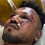 একেবারে অলৌকিক ঘটনা ঘটল! অভিশপ্ত এয়ার ইন্ডিয়ার ড্রিমলাইনার বিমানে থাকা কমপক্ষে এক যাত্রীর প্রাণরক্ষা পেল। বিশ্বাসকুমার রমেশ নামে ৪০ বছরের ওই ব্যক্তি এয়ার ইন্ডিয়ার ৭৮৭-৮ ড্রিমলাইনার বিমানের ১১এ আসনে বসেছিলেন। বরাতজোরে প্রাণে বেঁচে গিয়েছেন। আপাতত আমদাবাদের সিভিল হাসপাতালের তাঁর চিকিৎসা চলছে। জেনারেল বেডেই রাখা হয়েছে তাঁকে। (ছবি সৌজন্যে হিন্দুস্তান টাইমস)
