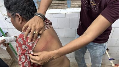 প্রকাশ্য বাজারে মারের চোটে কালসিটে পড়ল মন্ত্রীর স্বামীর পিঠে, কাঠগড়ায় বিজেপি