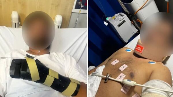 অস্ট্রেলিয়ায় ভারতীয় বংশোদ্ভূতকে চাপাতির কোপ একদল নাবালকের, হাত প্রায় বিচ্ছিন্ন অস্ট্রেলিয়ায় ভারতীয় বংশোদ্ভূতকে চাপাতির কোপ একদল নাবালকের, হাত প্রায় বিচ্ছিন্ন