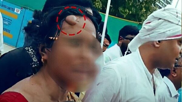 শুভেন্দু অধিকারীদের জন্যই আরজি করের নির্যাতিতার মায়ের কপালে চোট লেগেছে বলে অভিযোগ করলেন আন্দোলনকারী চিকিৎসকরা। চিকিৎসকদের প্রতিবাদ মঞ্চের তরফ থেকে বলা হয়, গত এক বছরে একাধিকবার নির্যাতিতার বাবা-মা'কে সঙ্গে নিয়ে তাঁরা মিছিল করেছেন। কিন্তু কখনও এরকম পরিস্থিতি তৈরি হয়নি। অথচ আজ আহত হলেন নির্যাতিতার মা। এই আবহে চিকিৎসকদের বক্তব্য, পুলিশও যেমন দায়ি, তেমন দায় এড়াতে পারেন না শুভেন্দুরাও। শুভেন্দু অধিকারীদের জন্যই আরজি করের নির্যাতিতার মায়ের কপালে চোট লেগেছে বলে অভিযোগ করলেন আন্দোলনকারী চিকিৎসকরা। চিকিৎসকদের প্রতিবাদ মঞ্চের তরফ থেকে বলা হয়, গত এক বছরে একাধিকবার নির্যাতিতার বাবা-মা'কে সঙ্গে নিয়ে তাঁরা মিছিল করেছেন। কিন্তু কখনও এরকম পরিস্থিতি তৈরি হয়নি। অথচ আজ আহত হলেন নির্যাতিতার মা। এই আবহে চিকিৎসকদের বক্তব্য, পুলিশও যেমন দায়ি, তেমন দায় এড়াতে পারেন না শুভেন্দুরাও।