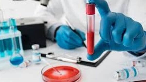 আট থেকে আশি, সকলেই পড়তে পারেন সেপসিসের ফাঁদে, প্রতিরোধের উপায় জানালেন চিকিৎসক