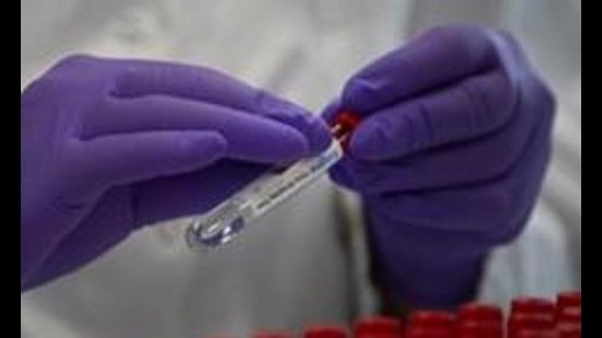 A lab technician puts a label on to a test tube while conducting research on coronavirus, Belgium, June 17, 2020 (AP) A lab technician puts a label on to a test tube while conducting research on coronavirus, Belgium, June 17, 2020 (AP)