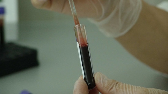In the IU clinical study, blood stem cell transplant patients received an oral drug called sitagliptin.(Pixabay) In the IU clinical study, blood stem cell transplant patients received an oral drug called sitagliptin.(Pixabay)