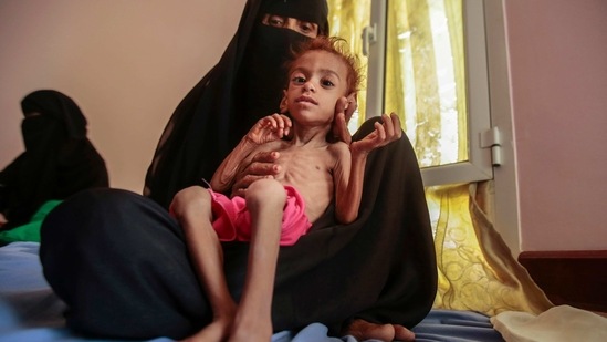 FILE - In this Oct. 1, 2018, file photo, a woman holds a malnourished boy at the Aslam Health Center, in Hajjah, Yemen. A leading aid organization on Monday warned that U.S. Secretary of State Mike Pompeo's move to designate Yemen’s Iran-backed Houthi rebels as a “foreign terrorist organization” would deal another “devastating blow" to the impoverished and war-torn nation. (AP Photo/Hani Mohammed, File)(AP) FILE - In this Oct. 1, 2018, file photo, a woman holds a malnourished boy at the Aslam Health Center, in Hajjah, Yemen. A leading aid organization on Monday warned that U.S. Secretary of State Mike Pompeo's move to designate Yemen’s Iran-backed Houthi rebels as a “foreign terrorist organization” would deal another “devastating blow" to the impoverished and war-torn nation. (AP Photo/Hani Mohammed, File)(AP)