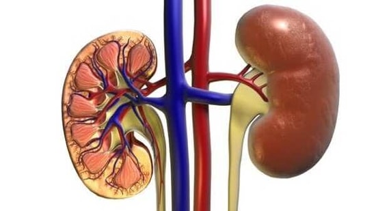 In a large population-based family study, family history of kidney disease was strongly associated with increased risk of chronic kidney disease.(ANI) In a large population-based family study, family history of kidney disease was strongly associated with increased risk of chronic kidney disease.(ANI)