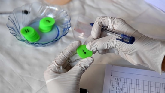 A staff member of the Rajawadi Hospital holds the first token to be given to a health worker to receive the Covid-19 vaccine in Mumbai on January 16. Prime Minister Narendra Modi launched the program with a speech addressing more than 3,000 centres across India, where the first shots were to be given.(Indranil Mukherjee / AFP)