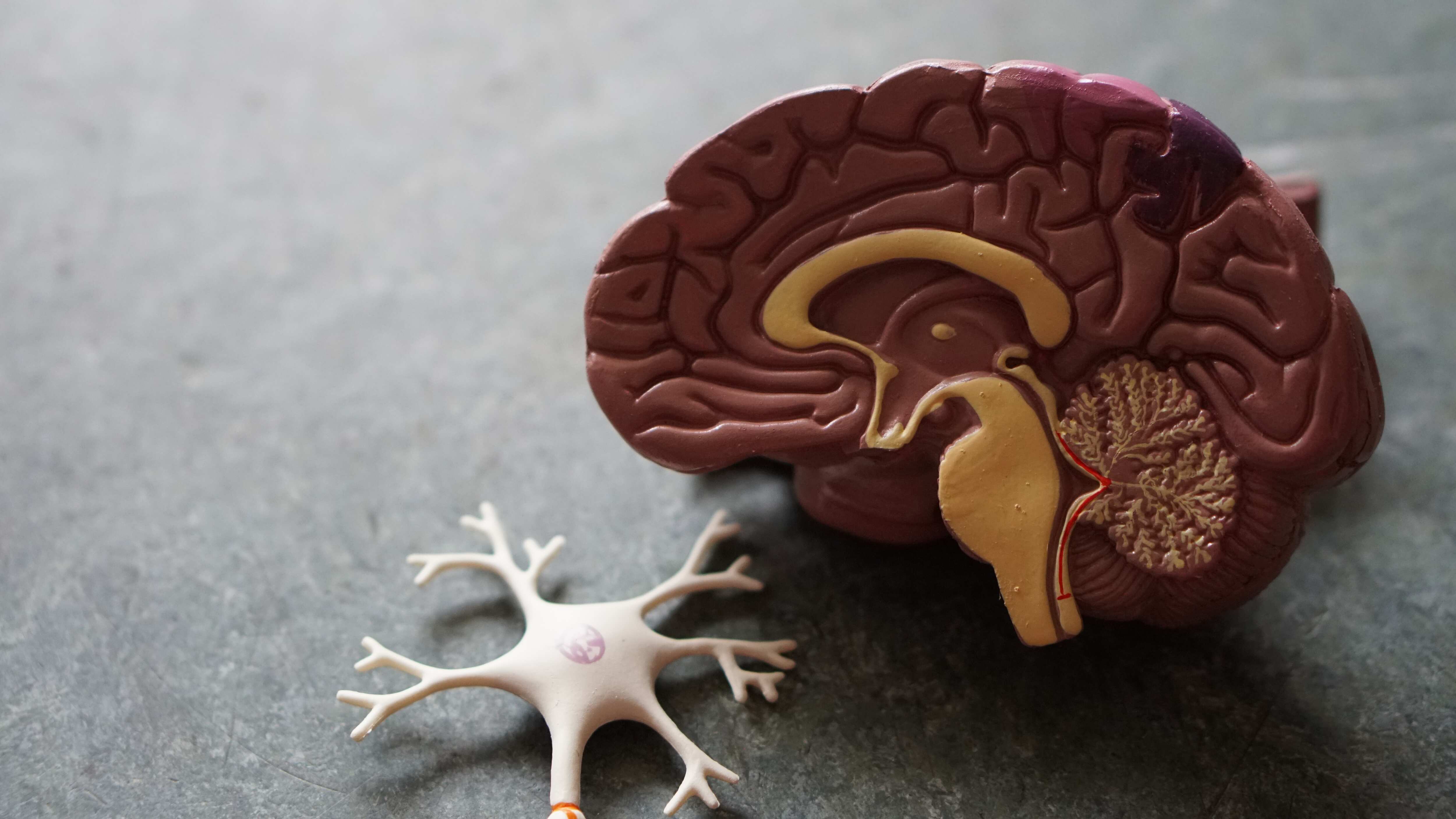 In the study, the team led by Universite de Montreal psychology professor Sylvie Belleville, found hyperactivation in certain brain areas in people not yet diagnosed with Alzheimer's but who were worried about their memory and who exhibited risk factors for the disease. (Unsplash) In the study, the team led by Universite de Montreal psychology professor Sylvie Belleville, found hyperactivation in certain brain areas in people not yet diagnosed with Alzheimer's but who were worried about their memory and who exhibited risk factors for the disease. (Unsplash)