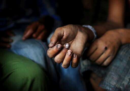 The 2011 census paints a grim picture and records that one in every 11 working individuals in India is a child in the age group of 5-18 years. (AP/Representative Image) The 2011 census paints a grim picture and records that one in every 11 working individuals in India is a child in the age group of 5-18 years. (AP/Representative Image)