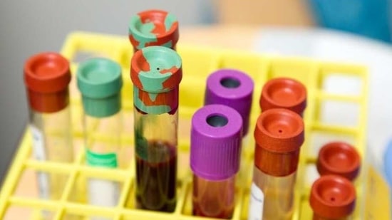 UK study suggests genetic screening before prescribing could benefit millions(Unsplash) UK study suggests genetic screening before prescribing could benefit millions(Unsplash)