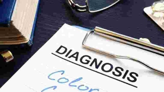Left-sided tumors have rounded masses, which are easier to detect in the early stages.(iStock) Left-sided tumors have rounded masses, which are easier to detect in the early stages.(iStock)