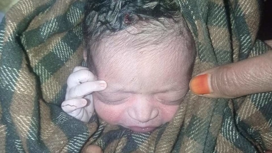 Both mother and daughter were taken to the hospital and admitted after the delivery.