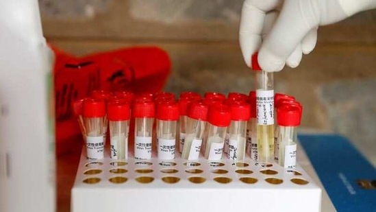 A health worker holds a tube containing a sample during free mass testing for the coronavirus disease. (Representative image) (REUTERS)