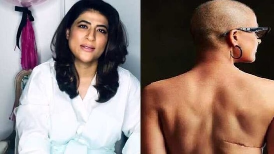 Tahira Kashyap has shared a poem about embracing scars like a badge of honour. Tahira Kashyap has shared a poem about embracing scars like a badge of honour.