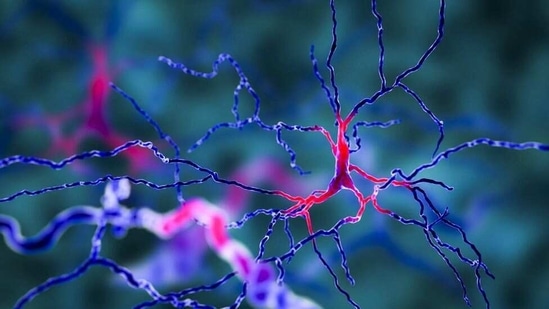 This study led by researchers from the University of Iowa, with colleagues in Denmark and China, has been published in the journal, JAMA Neurology.(Pixabay) This study led by researchers from the University of Iowa, with colleagues in Denmark and China, has been published in the journal, JAMA Neurology.(Pixabay)
