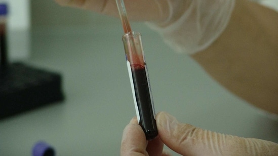 The findings reported in JCI Insight shows that even though bone marrow transplant can be a lifesaving procedure for patients with blood cancers. (Pixabay) The findings reported in JCI Insight shows that even though bone marrow transplant can be a lifesaving procedure for patients with blood cancers. (Pixabay)
