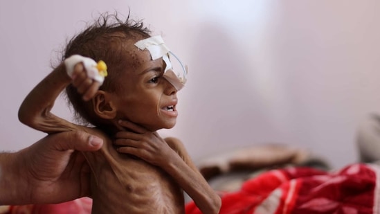 At least 400,000 Yemeni children under 5 could die of starvation this ...