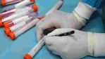 The test rates had been revised following a downward revision in other states, the order said. Delhi and Gujarat are among some states which have reduced charges of RT- PCR test.(Bloomberg) The test rates had been revised following a downward revision in other states, the order said. Delhi and Gujarat are among some states which have reduced charges of RT- PCR test.(Bloomberg)