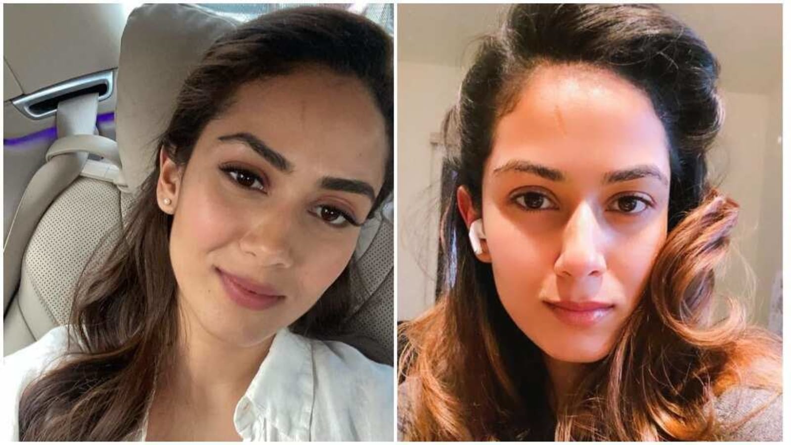 Mira Rajput reveals story behind the scar on her forehead and how she got it