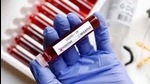 The report was compiled to find out the vulnerable group of patients and the measures that need to be taken to prevent more infections. (HT PHOTO) The report was compiled to find out the vulnerable group of patients and the measures that need to be taken to prevent more infections. (HT PHOTO)