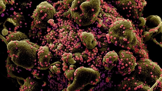 Colorized scanning electron micrograph of an apoptotic cell (greenish brown) heavily infected with SARS-COV-2 virus particles (pink), also known as novel coronavirus, isolated from a patient sample.(Reuters) Colorized scanning electron micrograph of an apoptotic cell (greenish brown) heavily infected with SARS-COV-2 virus particles (pink), also known as novel coronavirus, isolated from a patient sample.(Reuters)