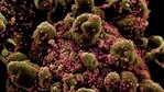 Researchers sequenced 750 genomes of the novel coronavirus from infected individuals and analysed mutations for their potential to alter T cell epitopes.(Reuters) Researchers sequenced 750 genomes of the novel coronavirus from infected individuals and analysed mutations for their potential to alter T cell epitopes.(Reuters)